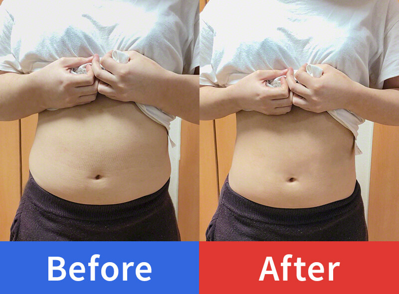 劇的！お腹ビフォーアフター！