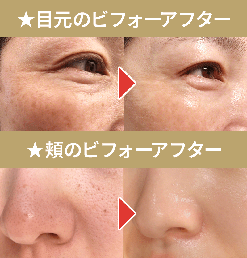 使い勝手の良さ ・小回りが利くもの ・短時間でケアできるもの ・防水機能つきなど