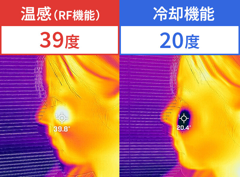 温感（RF機能） 冷却機能